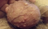 pryishhi-na-yaytsah-u-muzhchin-foto.png